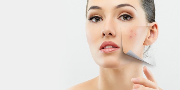 repair acne