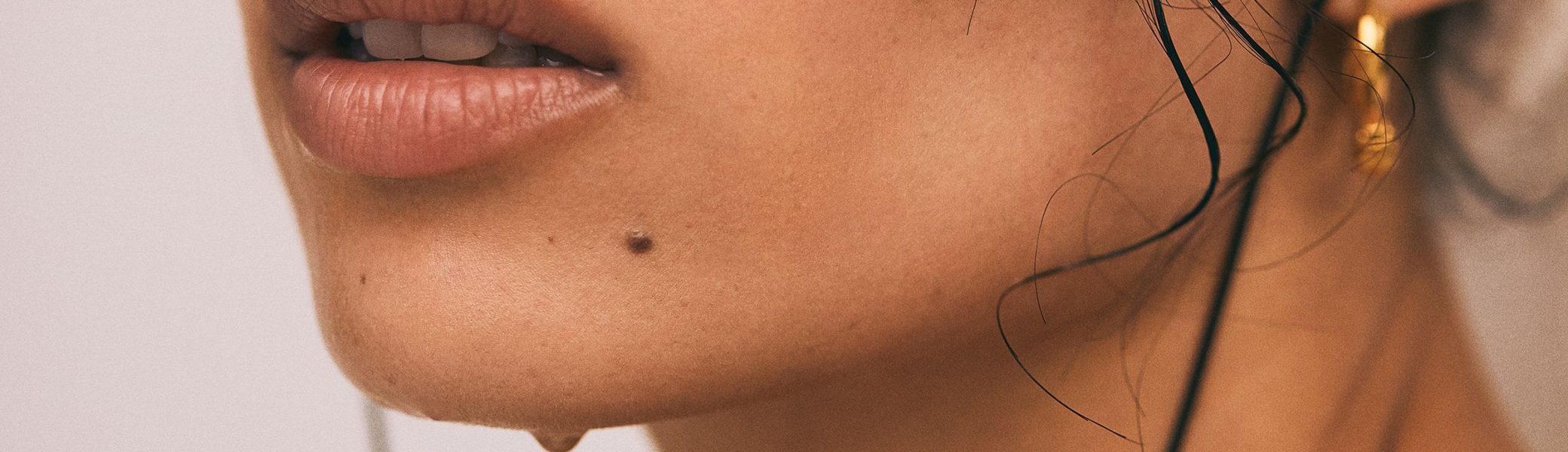 Facial Scar  Mole Revision in Mumbai  Tattoo Removal  Bombay Cosmetic  Clinics