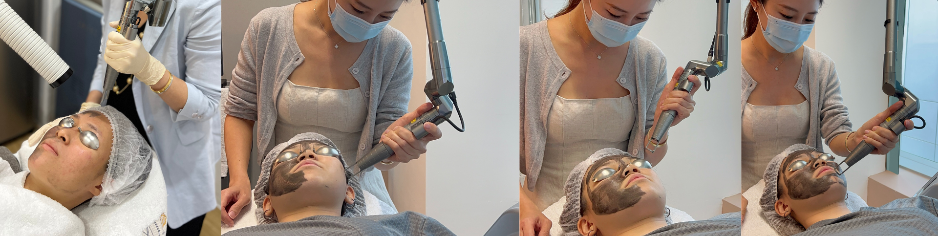 carbon laser treatment