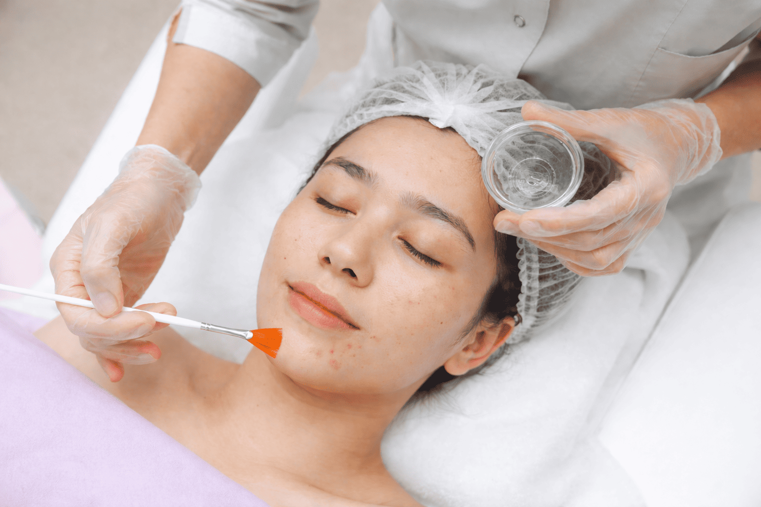 Woman receiving acne facial treatment with exfoliation at skincare clinic