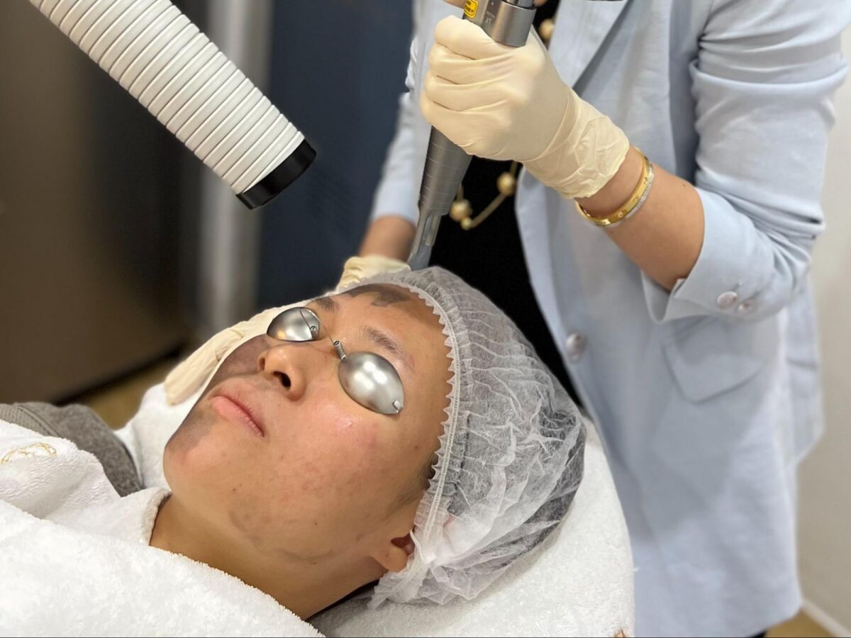 Patient receiving acne scar laser treatment on face at aesthetic clinic