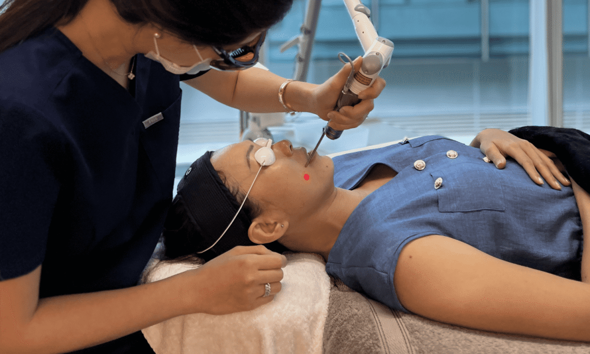 Laser acne scar treatment on face performed by aesthetic doctor in clinic