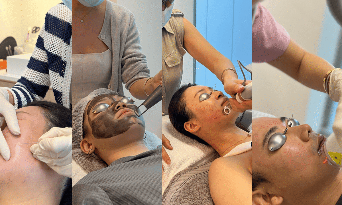 Acne scar treatment procedures including laser therapy, extraction and facial mask at aesthetic clinic