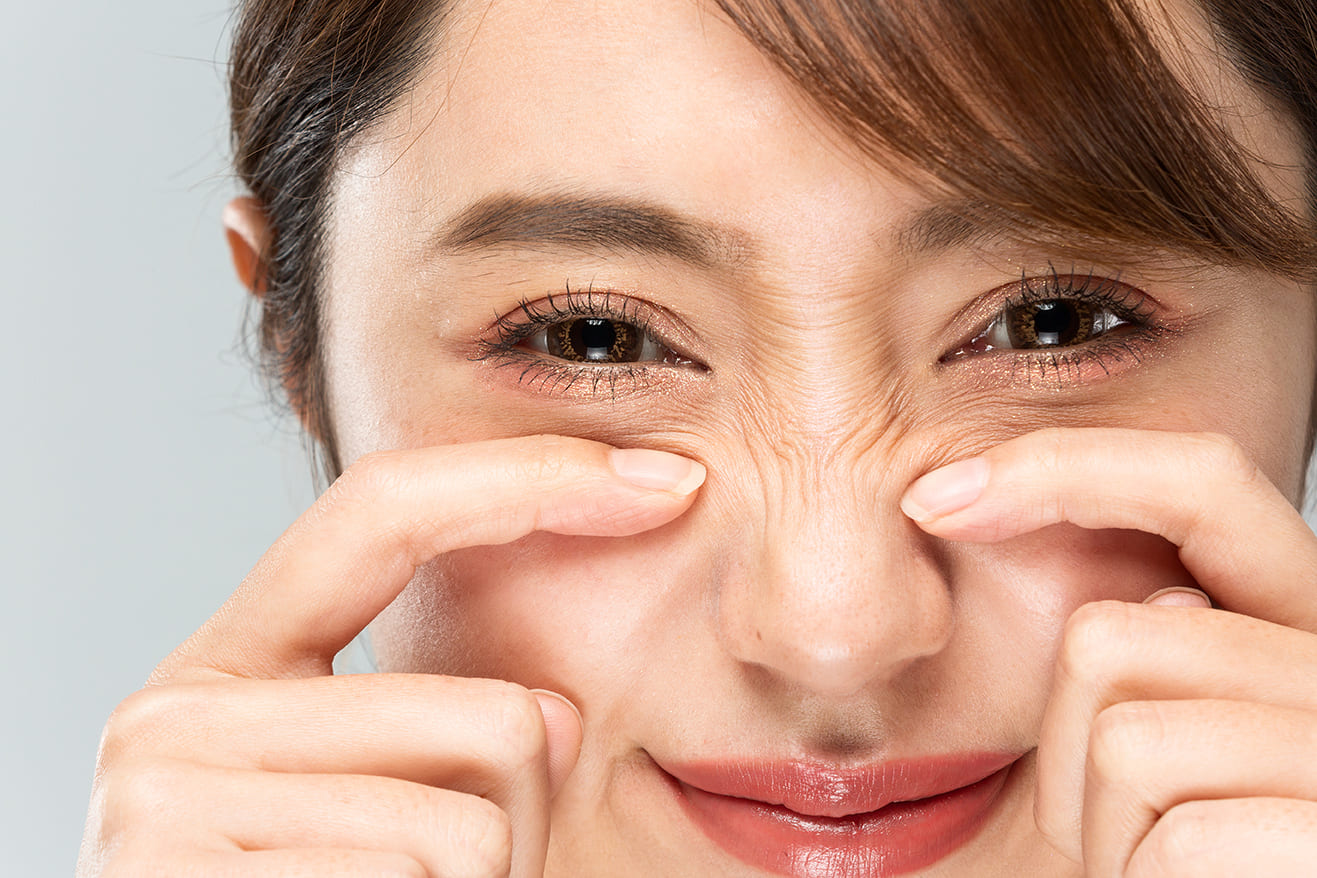 Bunny Lines (Nose Wrinkles): Causes, Treatments, and Prevention