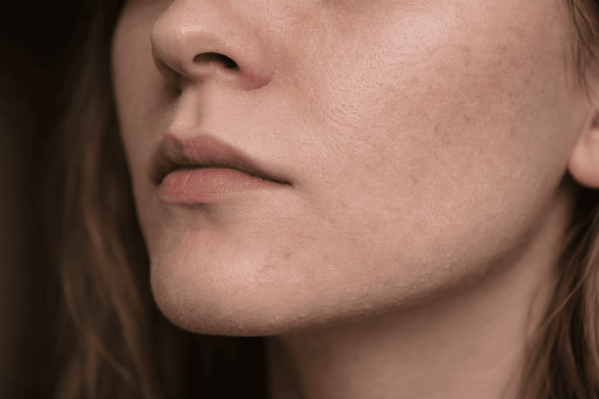 Close-up of a woman with dull skin
