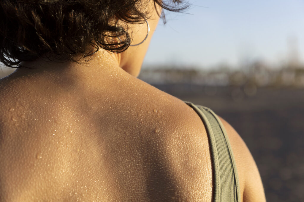 showing the back of a woman with excessive sweating