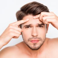 acne-scar-program-men