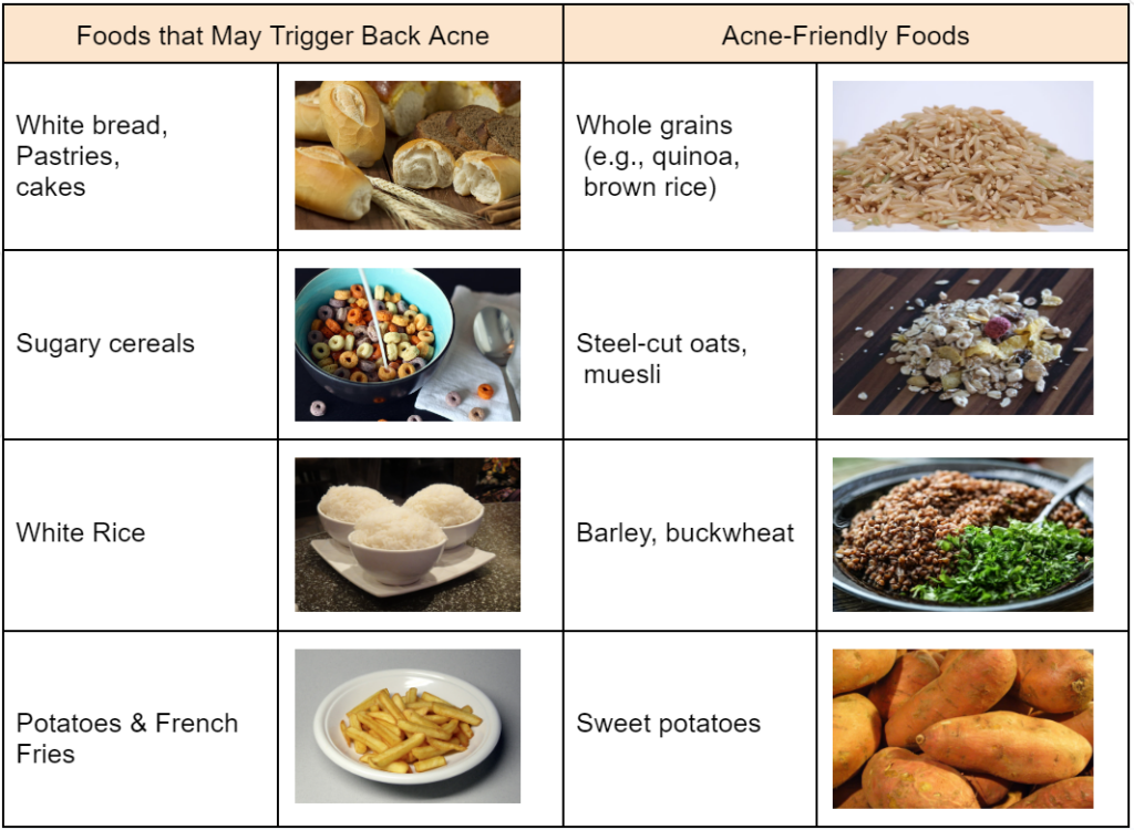 food that triggers acne vs acne-friendly foods