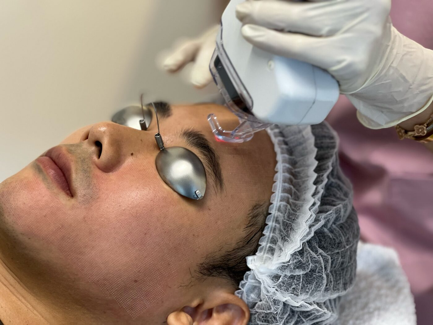 15 Best Products for Acne Scars - Healthline - How To Get Rid Of Acne