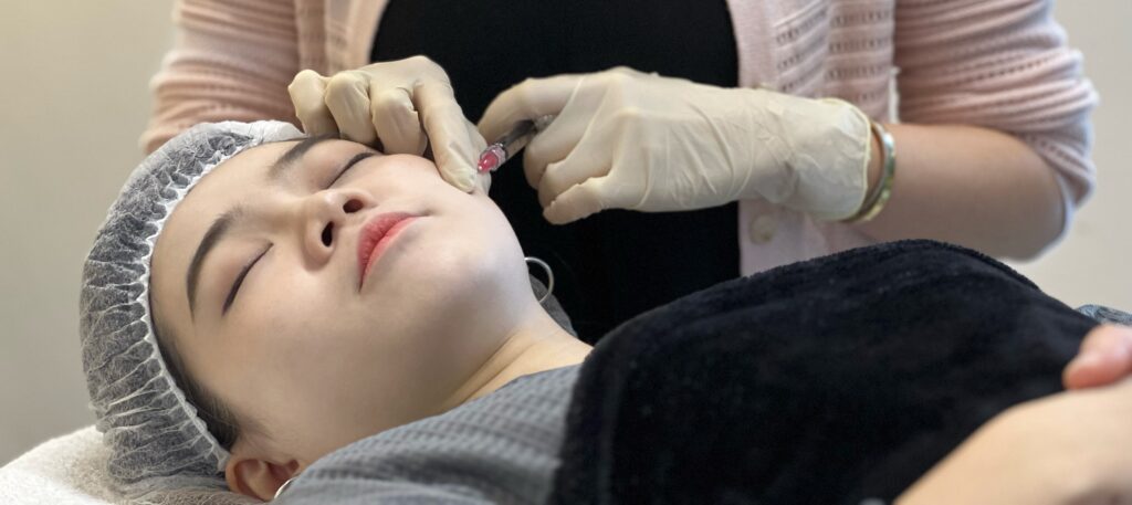 Injecting Profhilo to the face