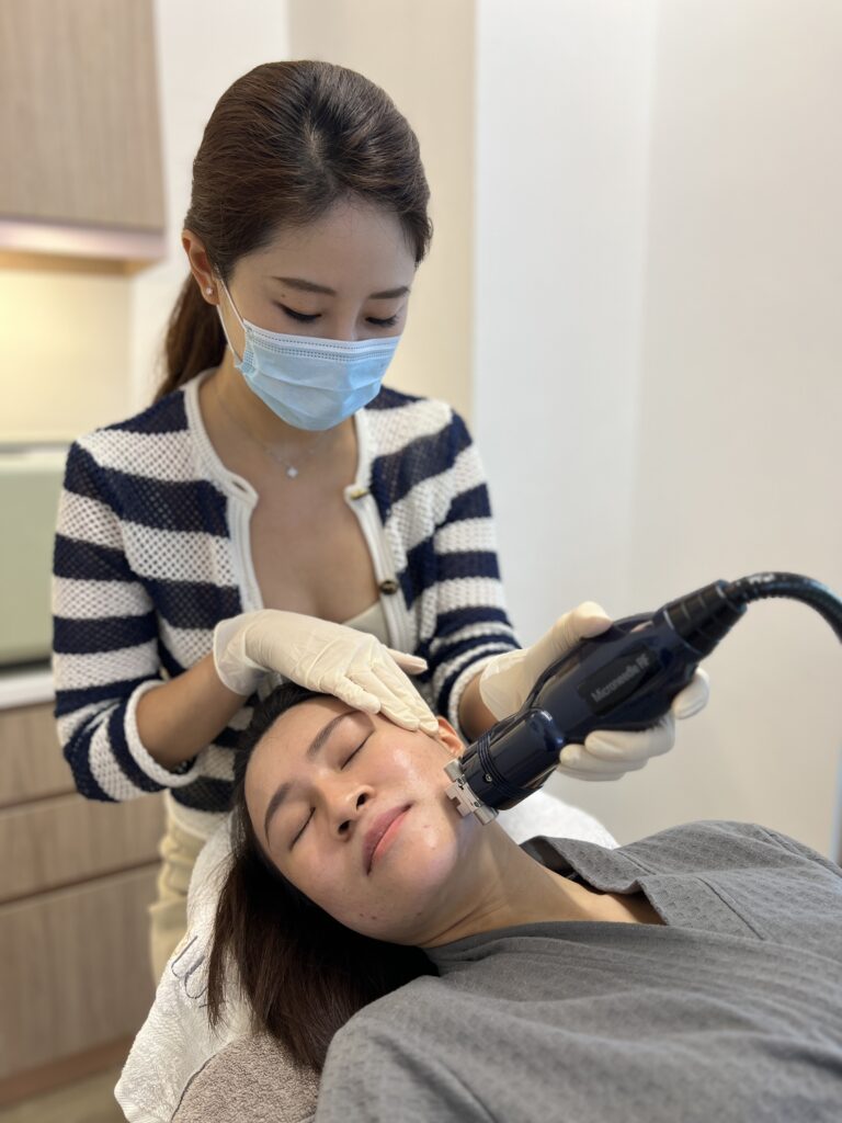 intracel microneedling