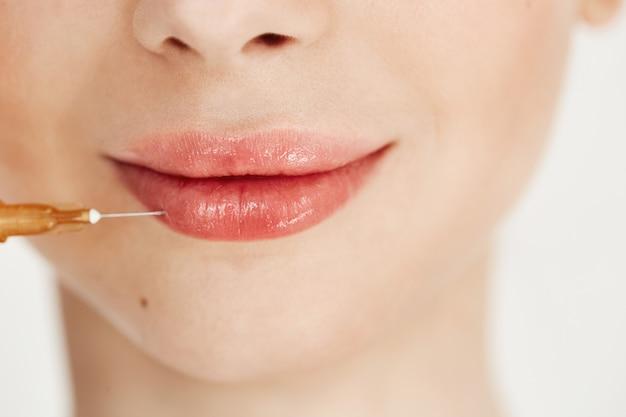 Close-up of lip filler injection for lip enhancement