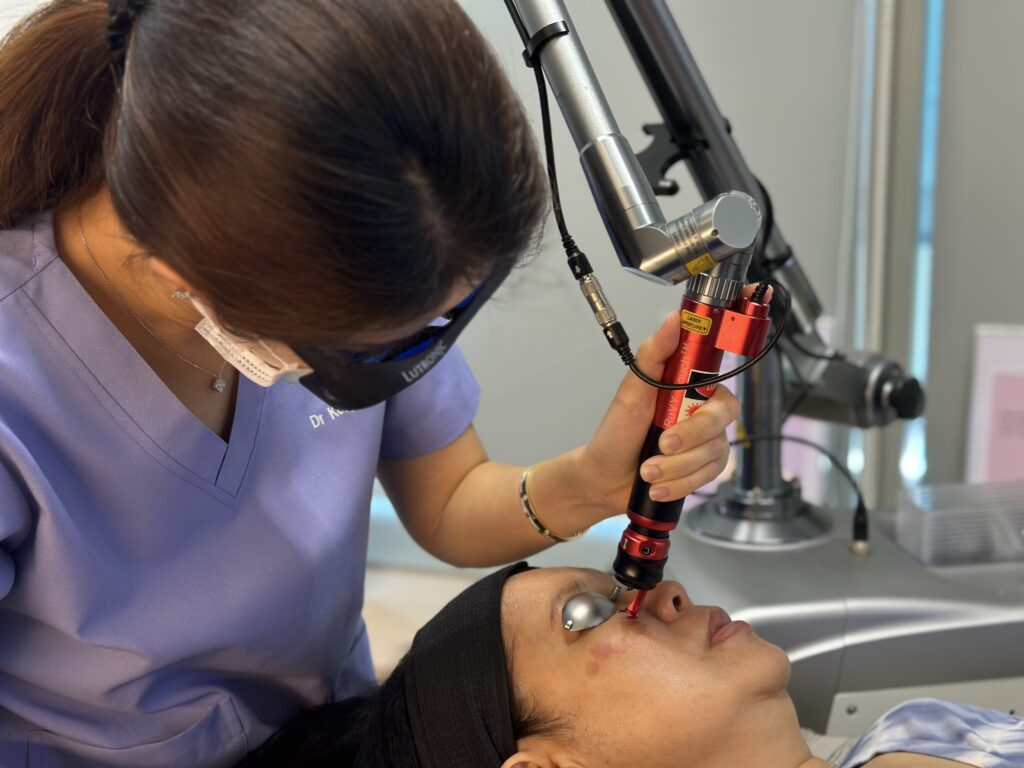 Q Switch Laser Treatment