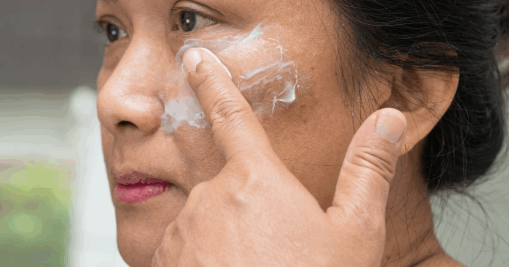 Asian woman applying cream to acne-prone skin as part of her daily facial skincare routine