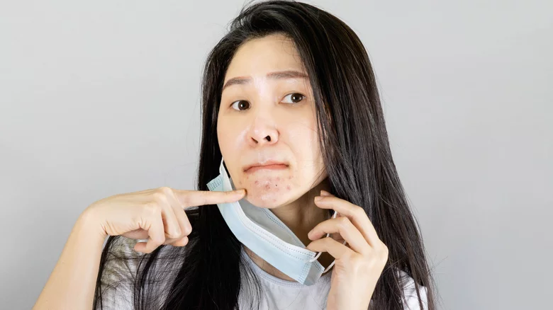 woman with acne